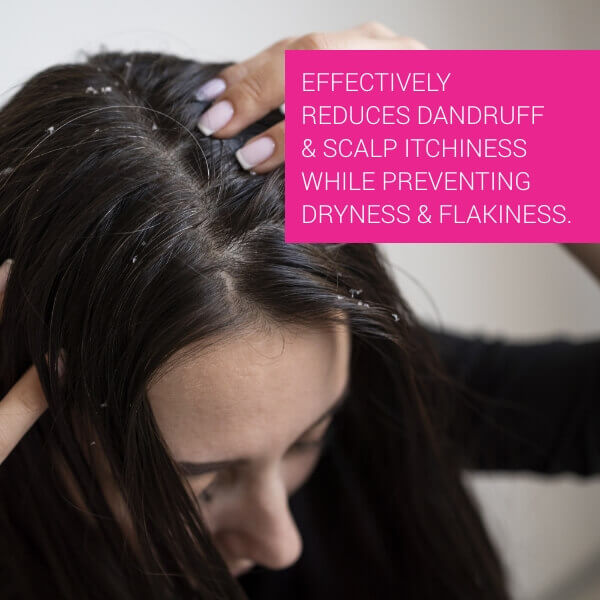 Scalp Renaissance Antidandruff Shampoo